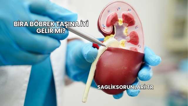 Bira Böbrek Taşına İyi Gelir mi?