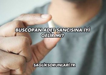 Buscopan Adet Sancısına İyi Gelir mi?