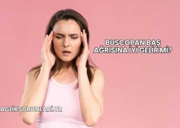 Buscopan Baş Ağrısına İyi Gelir mi?