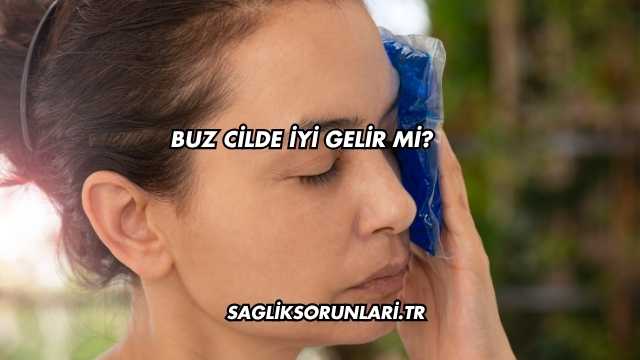 Buz Cilde İyi Gelir mi?