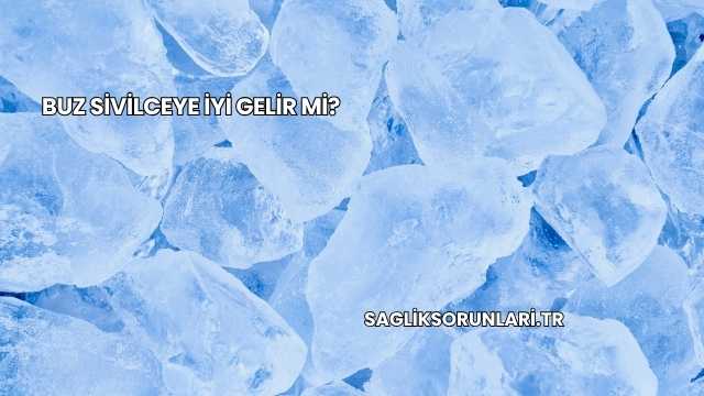 Buz Sivilceye İyi Gelir mi?