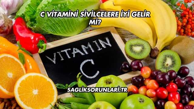 C Vitamini Sivilcelere İyi Gelir mi?