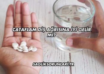 Cataflam Diş Ağrısına İyi Gelir mi?