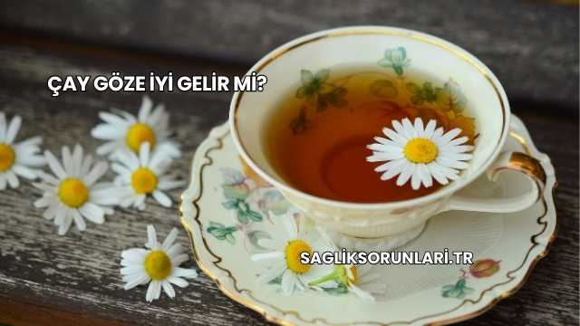 Çay Göze İyi Gelir mi?