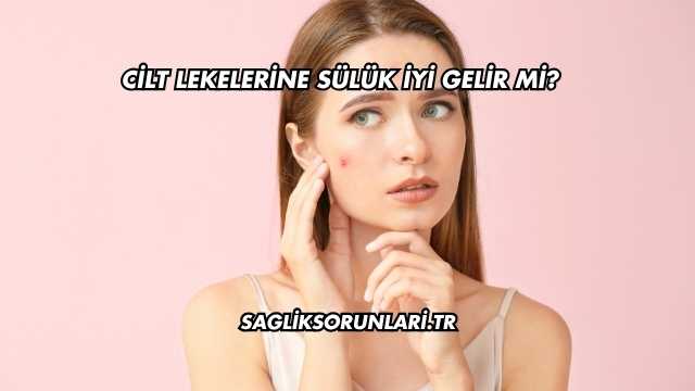 Cilt Lekelerine Sülük İyi Gelir mi?