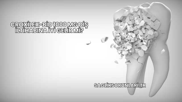 Croxilex-Bid 1000 Mg Diş İltihabına İyi Gelir mi?