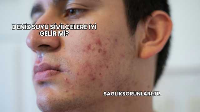 Deniz Suyu Sivilcelere İyi Gelir mi?