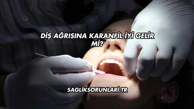 Diş Ağrısına Karanfil İyi Gelir mi?