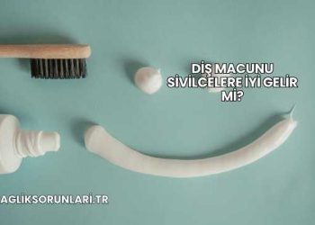 Diş Macunu Sivilcelere İyi Gelir mi?