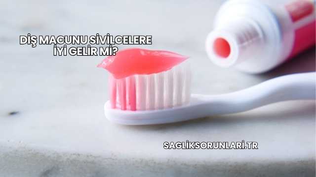Diş Macunu Sivilcelere İyi Gelir mi?