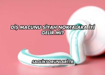Diş Macunu Siyah Noktalara İyi Gelir mi?
