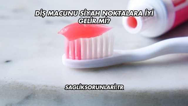 Diş Macunu Siyah Noktalara İyi Gelir mi?