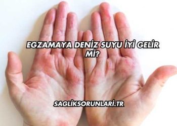 Egzamaya Deniz Suyu İyi Gelir mi?