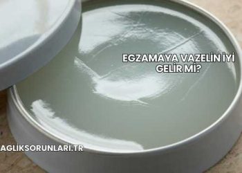 Egzamaya Vazelin İyi Gelir mi?