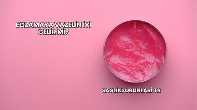 Egzamaya Vazelin İyi Gelir mi?