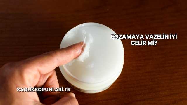 Egzamaya Vazelin İyi Gelir mi?