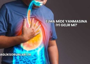 Elma Mide Yanmasına İyi Gelir mi?