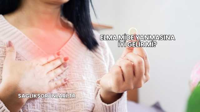 Elma Mide Yanmasına İyi Gelir mi?