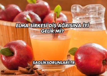 Elma Sirkesi Diş Ağrısına İyi Gelir mi?