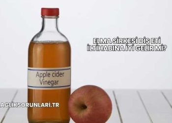 Elma Sirkesi Diş Eti İltihabına İyi Gelir mi?
