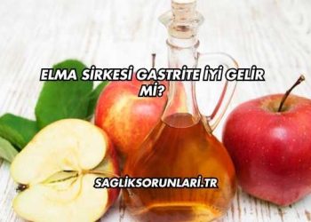 Elma Sirkesi Gastrite İyi Gelir mi?