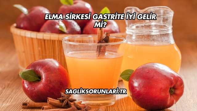 Elma Sirkesi Gastrite İyi Gelir mi?