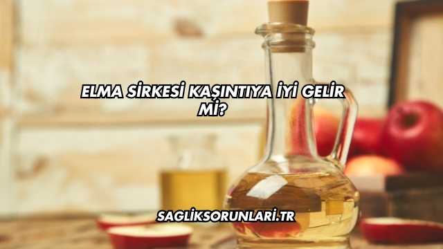 Elma Sirkesi Kaşıntıya İyi Gelir mi?