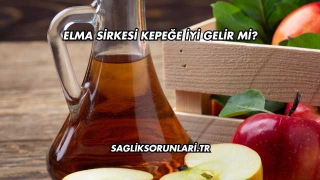 Elma Sirkesi Kepeğe İyi Gelir mi?