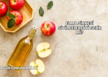 Elma Sirkesi Sivilcelere İyi Gelir mi?