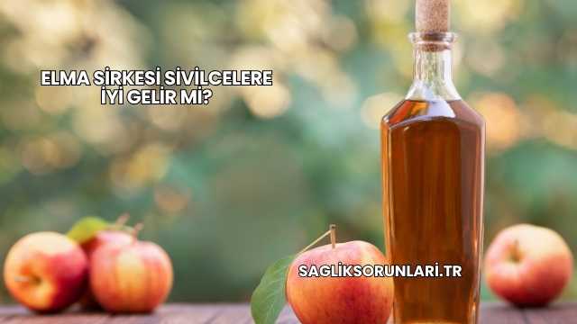 Elma Sirkesi Sivilcelere İyi Gelir mi?