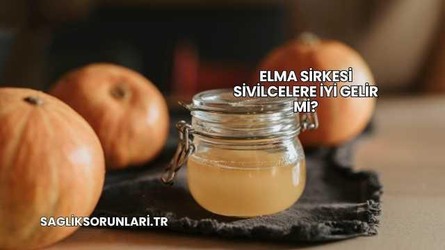 Elma Sirkesi Sivilcelere İyi Gelir mi?