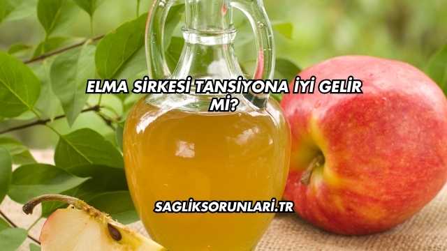 Elma Sirkesi Tansiyona İyi Gelir mi?