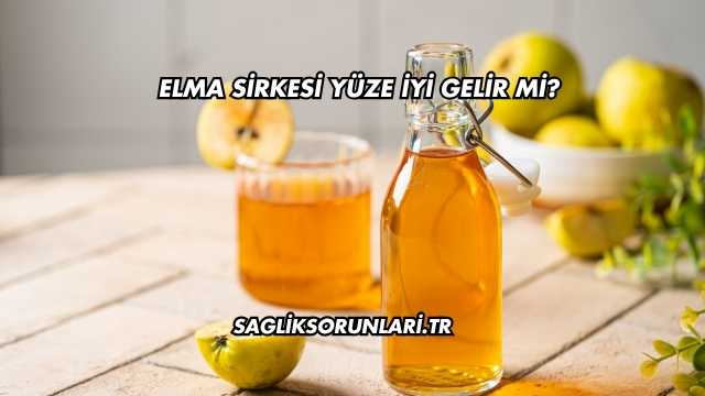 Elma Sirkesi Yüze İyi Gelir mi?