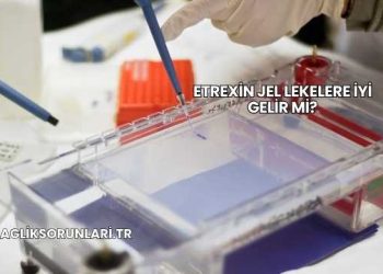 Etrexin Jel Lekelere İyi Gelir mi?
