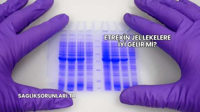 Etrexin Jel Lekelere İyi Gelir mi?