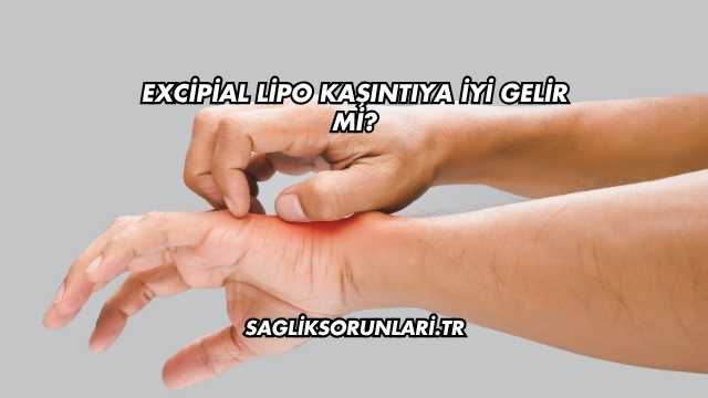 Excipial Lipo Kaşıntıya İyi Gelir mi?