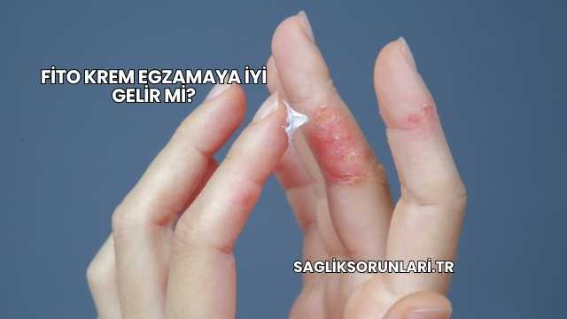 Fito Krem Egzamaya İyi Gelir mi?