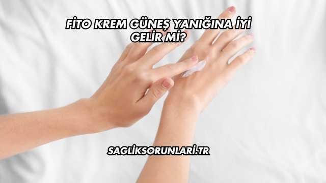Fito Krem Güneş Yanığına İyi Gelir mi?