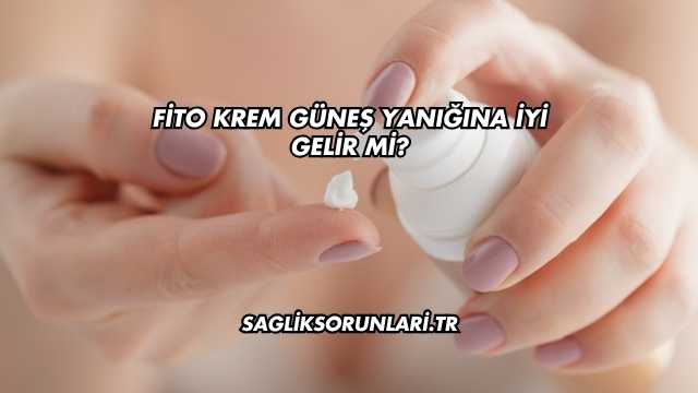 Fito Krem Güneş Yanığına İyi Gelir mi?