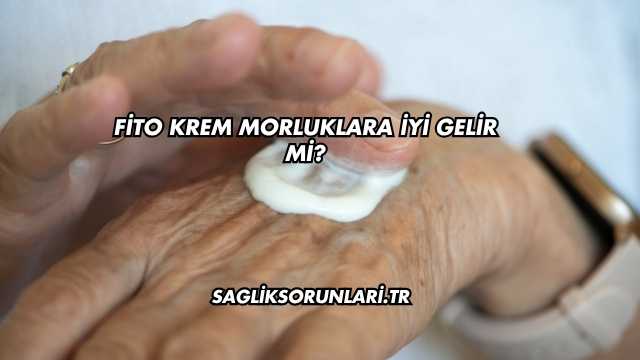 Fito Krem Morluklara İyi Gelir mi