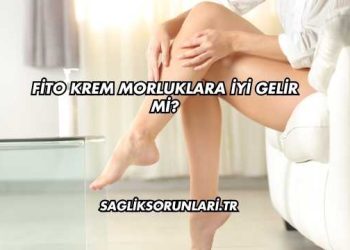 Fito Krem Morluklara İyi Gelir mi?