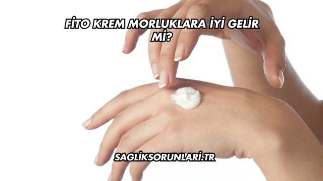 Fito Krem Morluklara İyi Gelir mi?