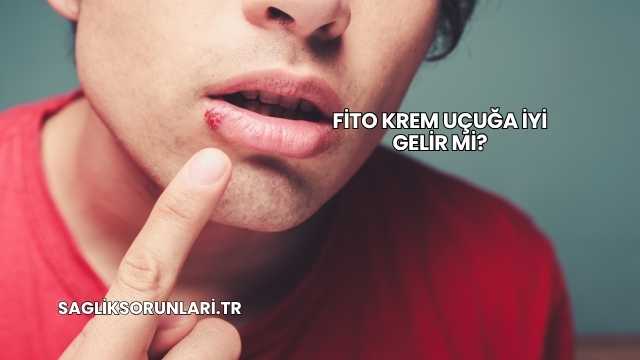 Fito Krem Uçuğa İyi Gelir mi?