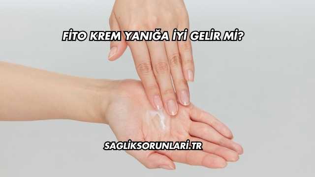 Fito Krem Yanığa İyi Gelir mi?