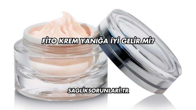 Fito Krem Yanığa İyi Gelir mi?