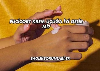 Fucicort Krem Uçuğa İyi Gelir mi