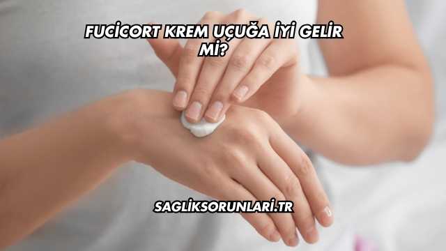 Fucicort Krem Uçuğa İyi Gelir mi