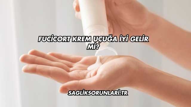 Fucicort Krem Uçuğa İyi Gelir mi