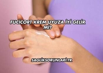 Fucicort Krem Uyuza İyi Gelir mi?