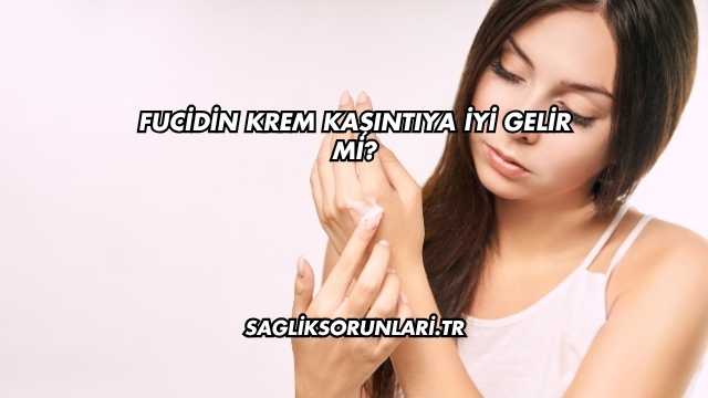 Fucidin Krem Kaşıntıya İyi Gelir mi?